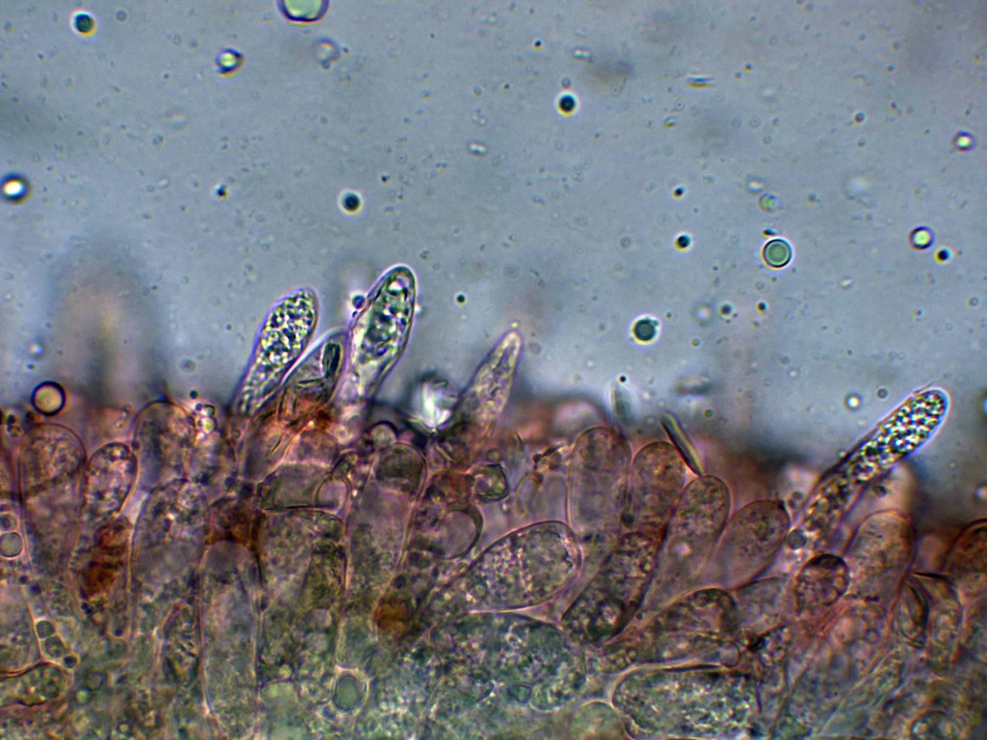 Microscopía de Lactifluus vellereus - 10 - Cistidios-001